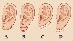 Personality Type Test: What Your Ear Shape Says About Your Character