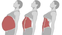 A Toned Stomach and a Slim Waist: 4 Exercises Worth Trying